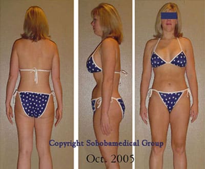 testimonials medical weight loss patient soboba