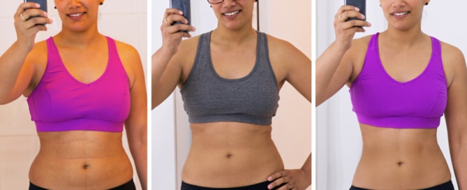 weight loss clinic orange county ca